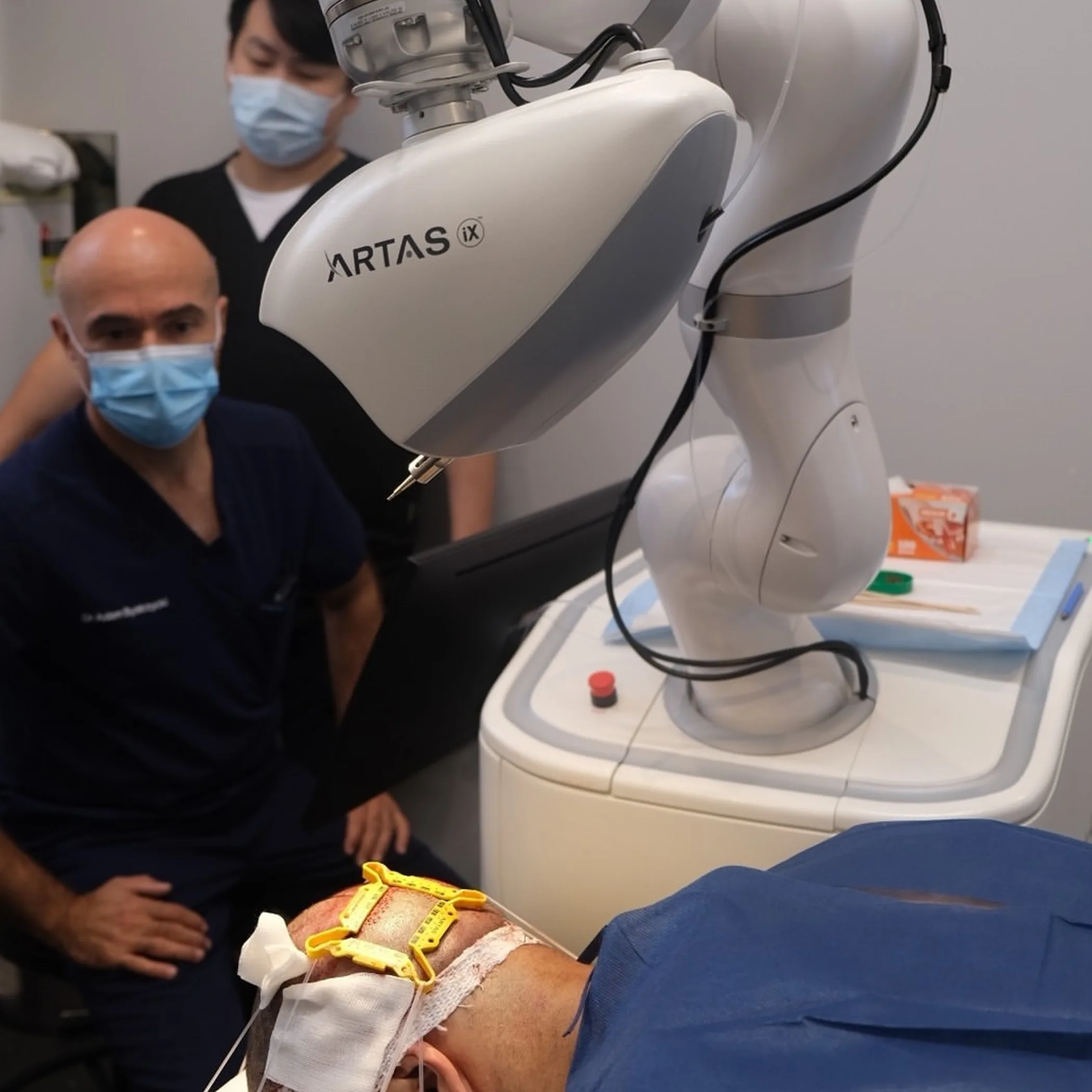 artas robot during hair restoration procedure