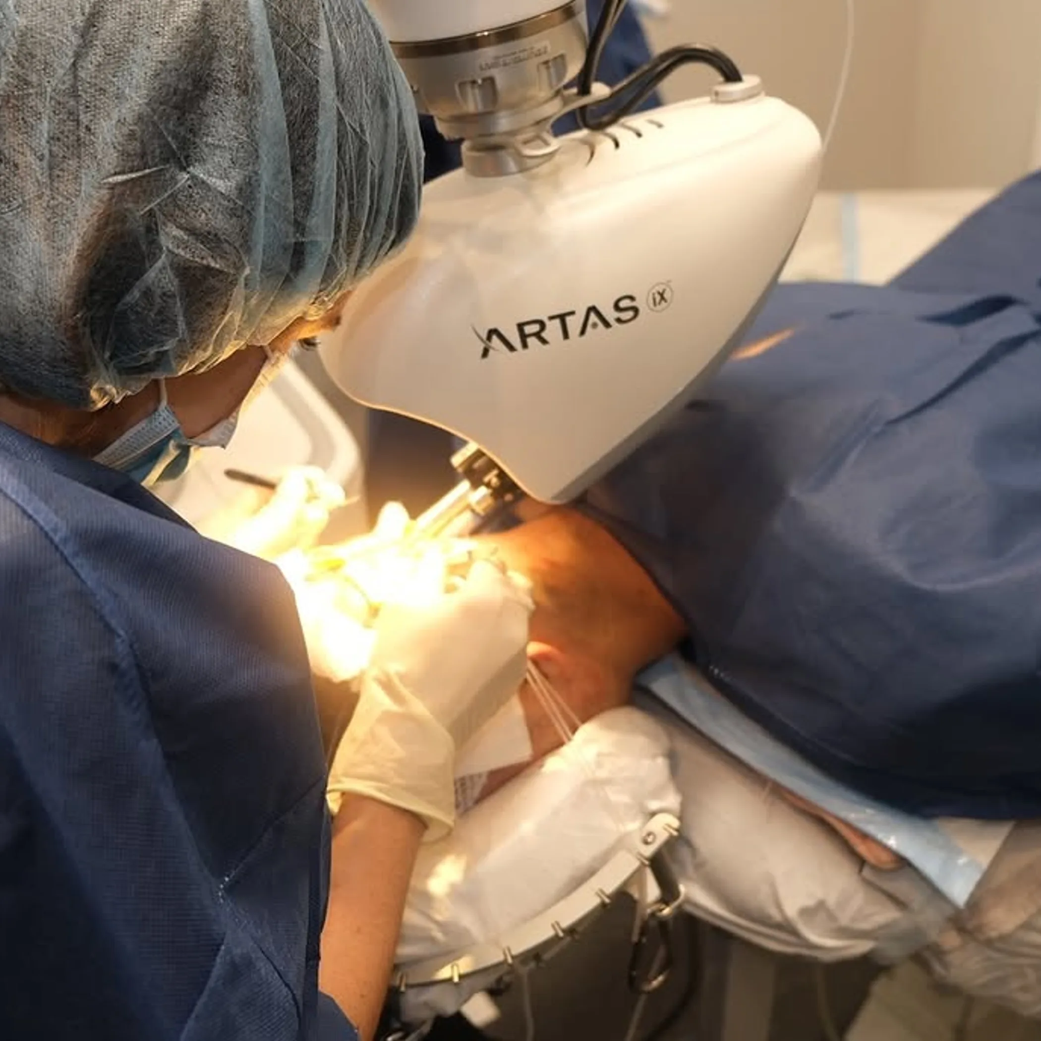 artas robotic hair restoration procedure