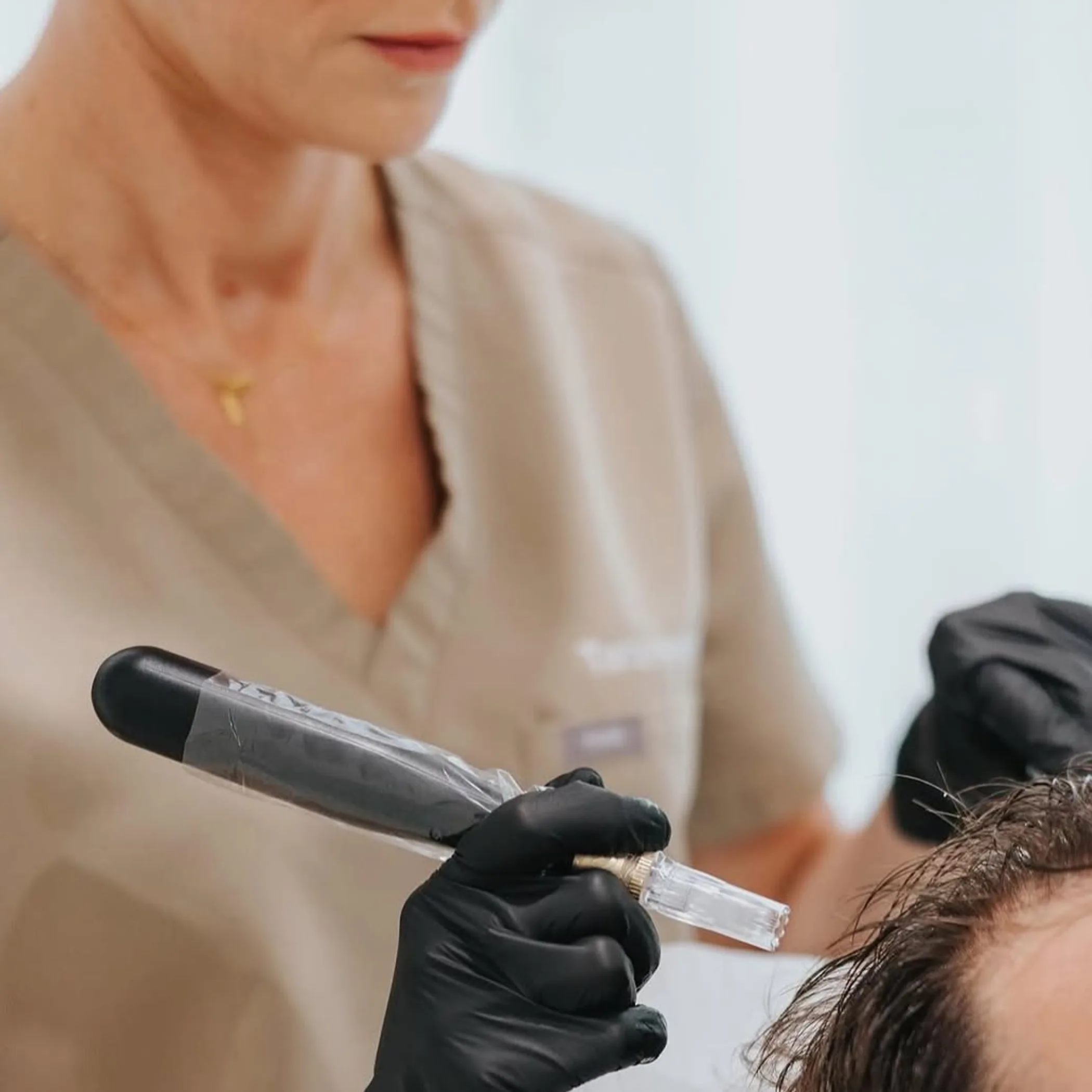 hair restoration procedure in progress